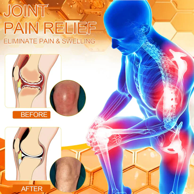 ✅Official Store: flysmus™ Bee-Venom Pain-Relief Bone Healing Cream👨⚕️British Osteopathic Medical Association (BOA) Approved(Reducing joint swelling, pain, stiffness, redness, warmth, soreness, and joint fatigue)