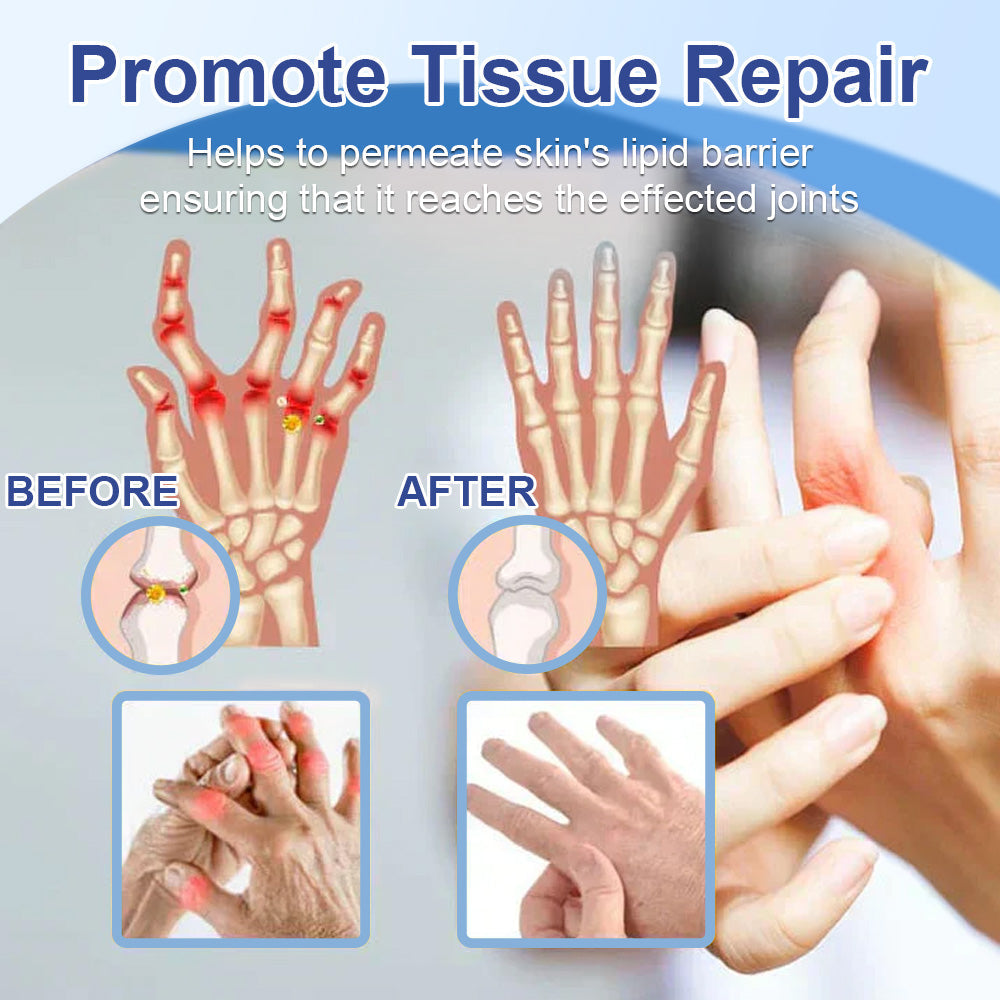 ✅Ourlyard™Official Store: Magnesium Pain Relief Repair Cream 👨⚕️Approved by the Medicines and Healthcare products Regulatory Agency (MHRA) (Relief of neuropathy, muscle spasms, cramps or twitches, poor bone health and other problems)