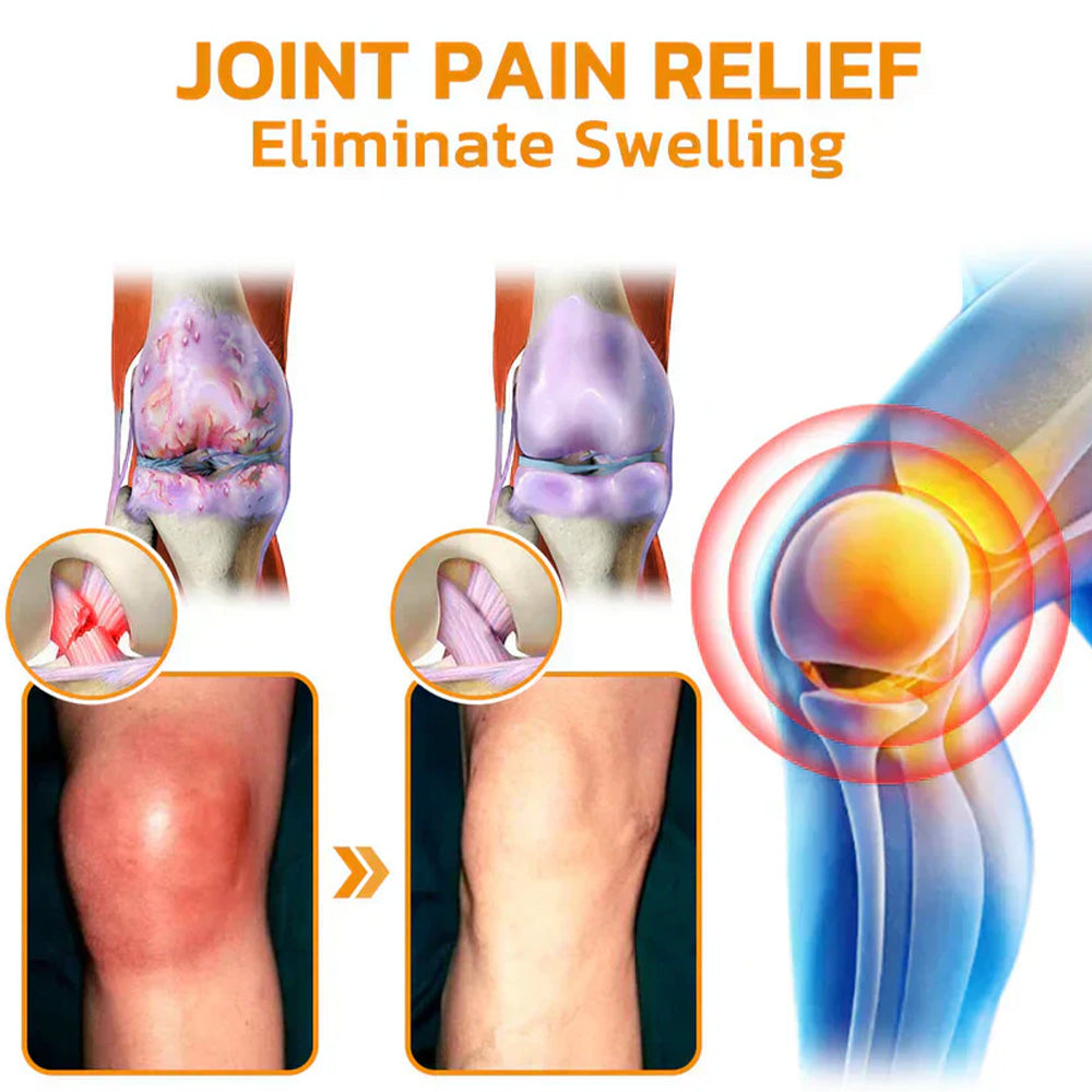 đ§đOurlyard⢠Magnesium Oil & Bee Venom Joint Healing Sprayđ¨ââď¸Orthopaedic Association (BOA) Approved