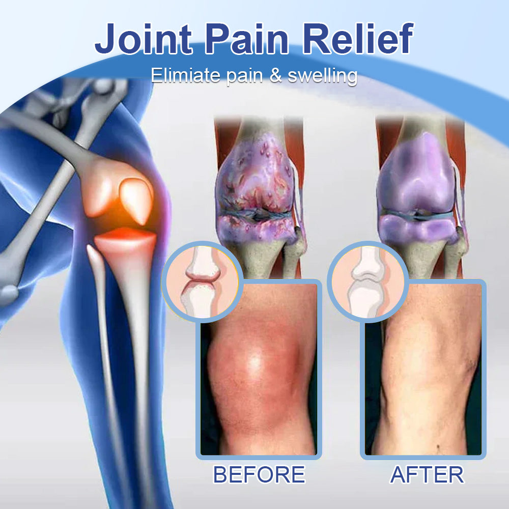 ✅Official Store: flysmus™ Magnesium Pain Relief Repair Cream 👨⚕️ Approved by the Medical Products Regulatory Agency (MHRA) (Relief of neuropathy, muscle spasms, cramps or twitches, poor bone health and other problems)