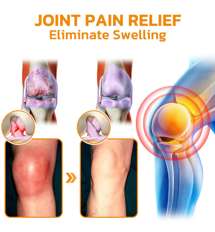 ✅Official Store: flysmus™ Bee-Venom Pain-Relief Bone Healing Cream👨⚕️British Osteopathic Medical Association (BOA) Approved(Reducing joint swelling, pain, stiffness, redness, warmth, soreness, and joint fatigue)