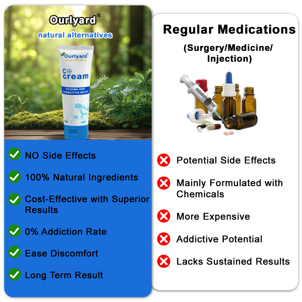 ✅NHS Approved: Ourlyard® Skin Treatment Cream(Relieves dermatitis, eczema, psoriasis, pigmentation, dry skin, and other common skin issues)