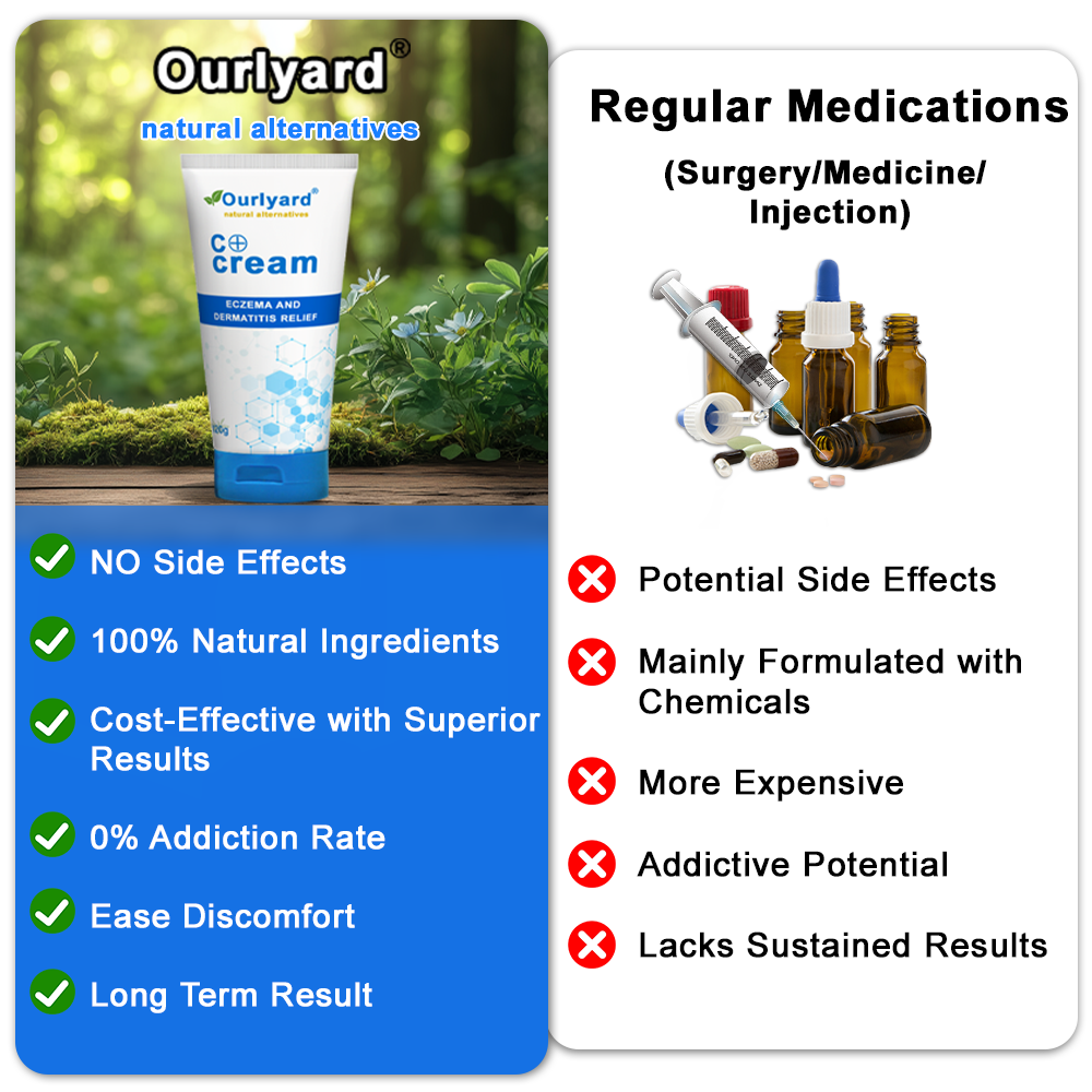 ✅NHS Approved: Ourlyard® Eczema Cream Skin Treatment(Relieves eczema, dermatitis, psoriasis, skin allergies, skin irritation, pigmentation, dry skin, and other common skin issues.)