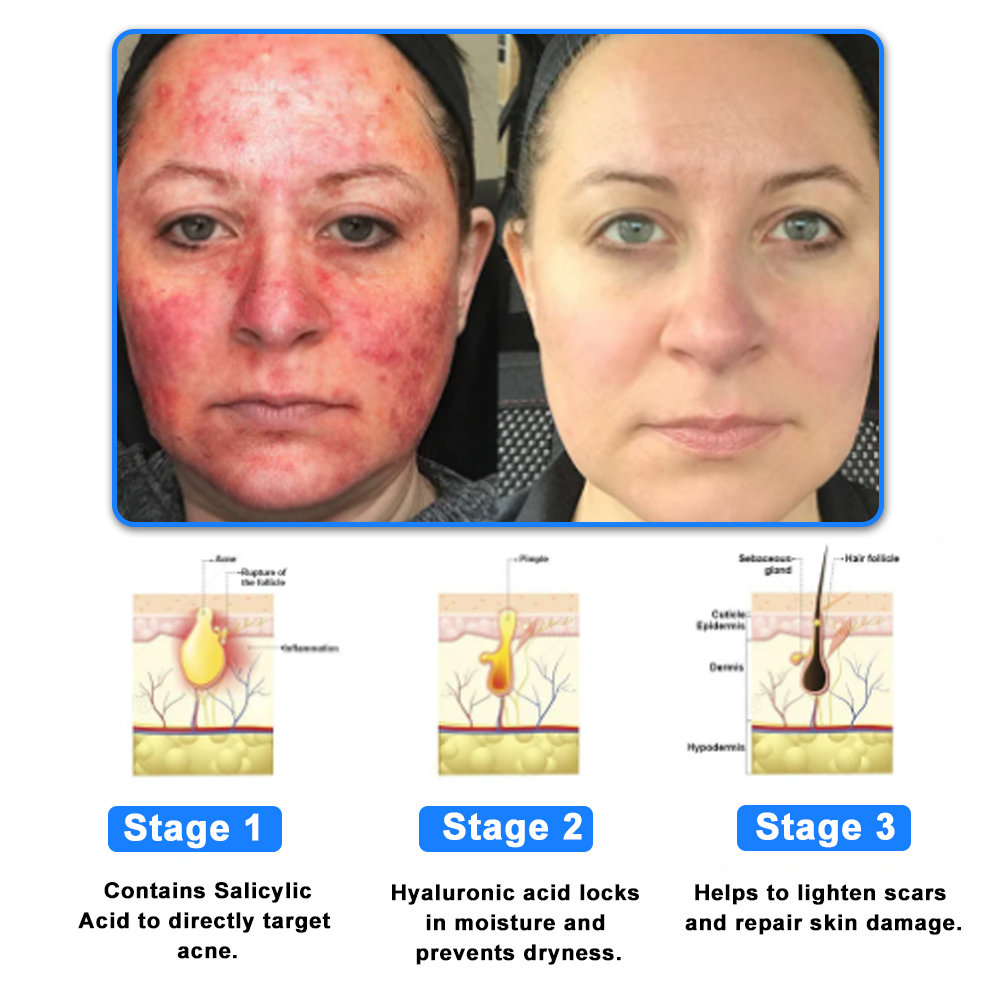 ✅NHS Approved: Ourlyard® Skin Treatment Cream(Relieves dermatitis, eczema, psoriasis, pigmentation, dry skin, and other common skin issues)
