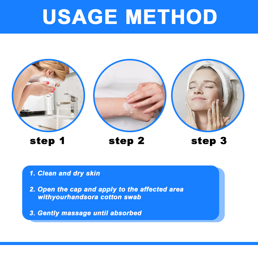 ✅NHS Approved: Ourlyard® Skin Treatment Cream(Relieves dermatitis, eczema, psoriasis, pigmentation, dry skin, and other common skin issues)