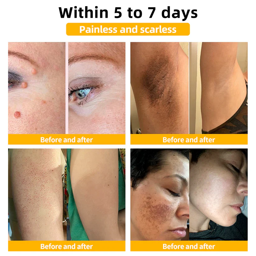 OurlyardÂŽ Official Store: Bee Venom Skin Treatment Creamđ¨ââď¸British Association of Dermatologists (BAD) Approved
