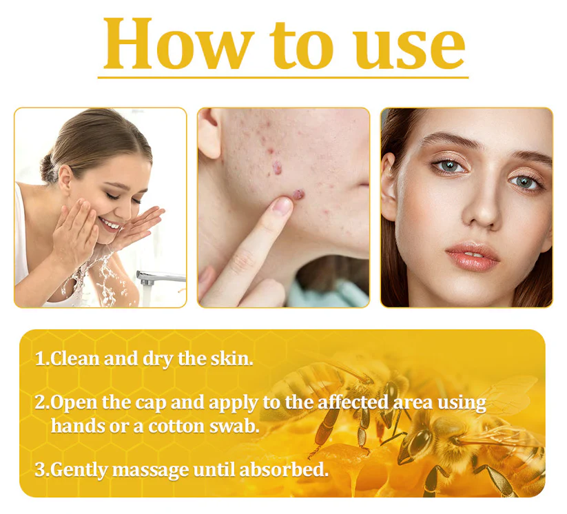 OurlyardÂŽ Official Store: Bee Venom Skin Treatment Creamđ¨ââď¸British Association of Dermatologists (BAD) Approved