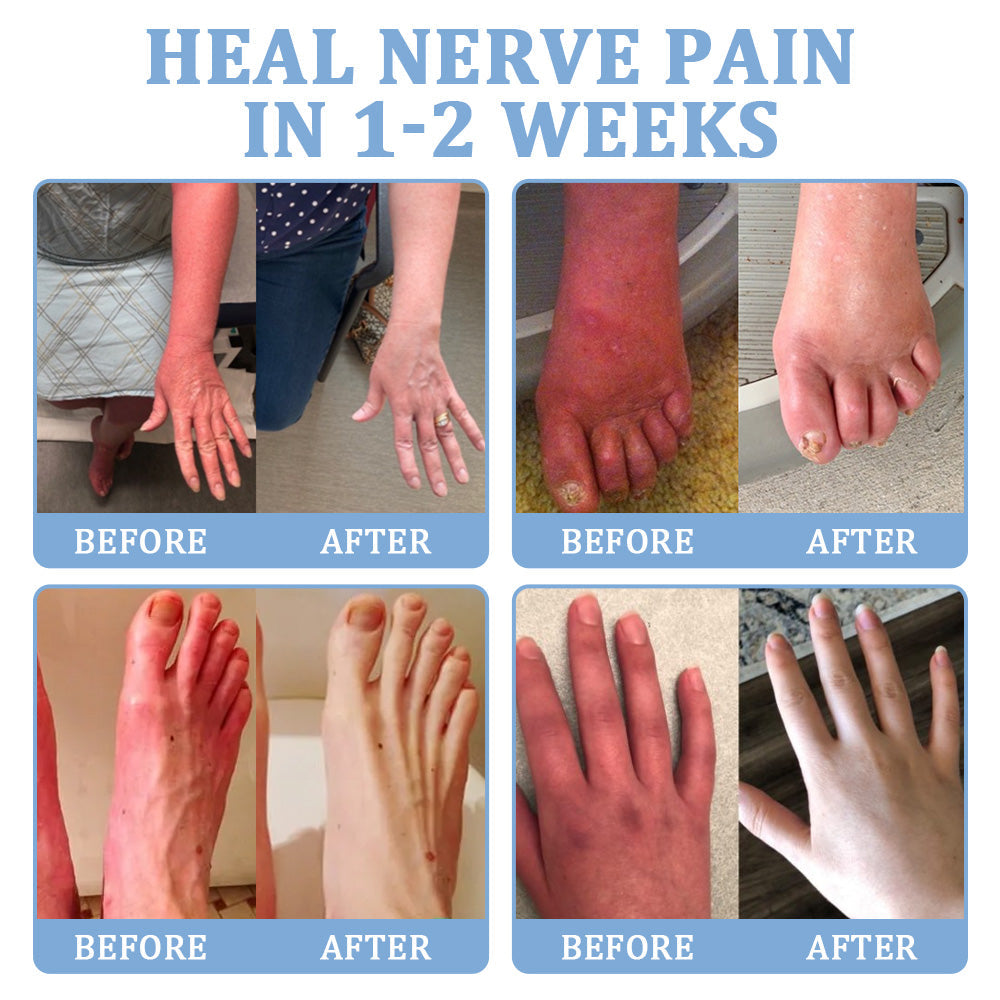 ✅Official Store: flysmus™ Magnesium Pain Relief Repair Cream 👨⚕️ Approved by the Medical Products Regulatory Agency (MHRA) (Relief of neuropathy, muscle spasms, cramps or twitches, poor bone health and other problems)