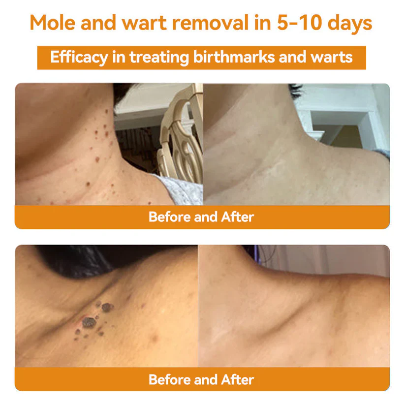 OurlyardÂŽ Official Store: Bee Venom Skin Treatment Creamđ¨ââď¸British Association of Dermatologists (BAD) Approved