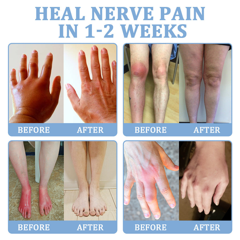 ✅Official Store: flysmus™ Magnesium Pain Relief Repair Cream 👨⚕️ Approved by the Medical Products Regulatory Agency (MHRA) (Relief of neuropathy, muscle spasms, cramps or twitches, poor bone health and other problems)