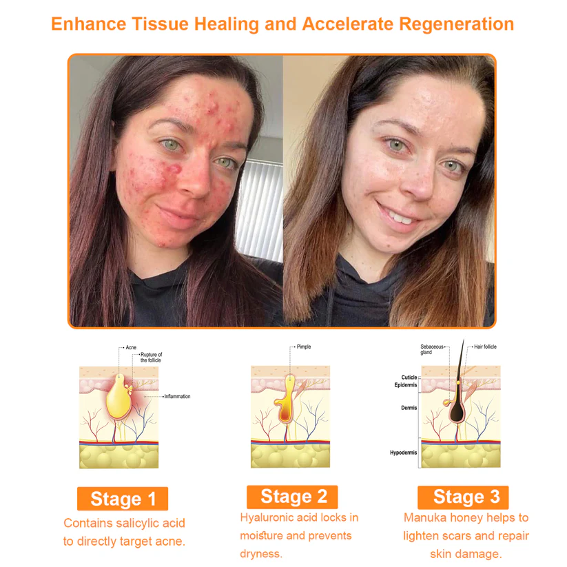 OurlyardÂŽ Official Store: Bee Venom Skin Treatment Creamđ¨ââď¸British Association of Dermatologists (BAD) Approved