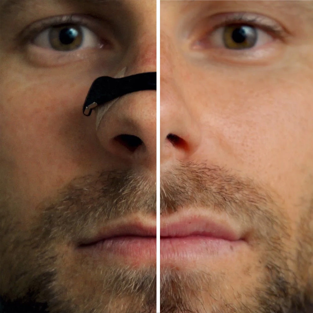 ✅Official Store:Ourlyard™ Magnetic Nasal Band