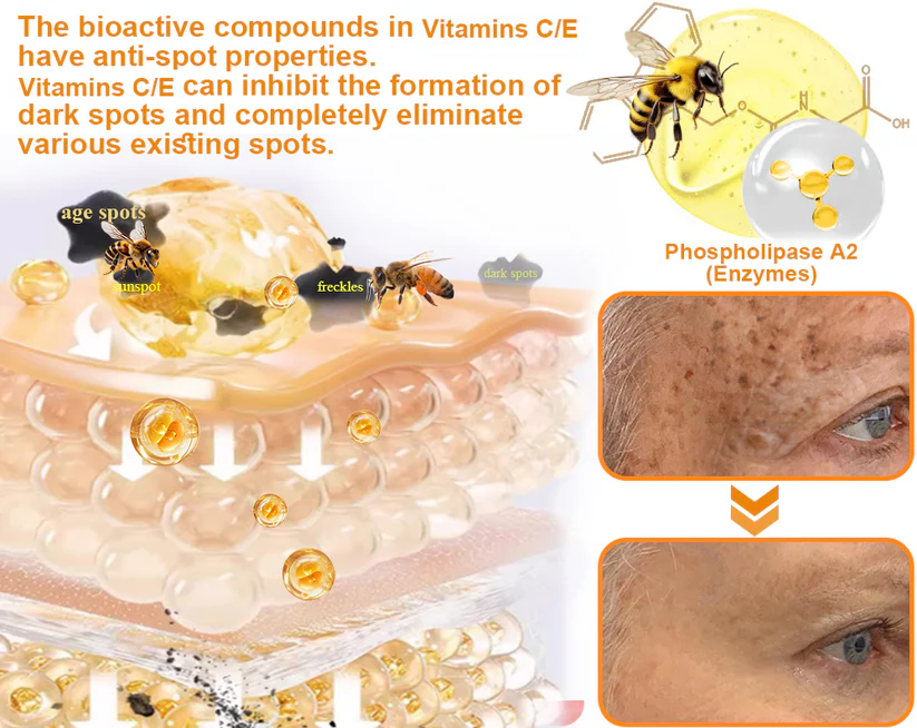 OurlyardÂŽ Official Store: Bee Venom Skin Treatment Creamđ¨ââď¸British Association of Dermatologists (BAD) Approved