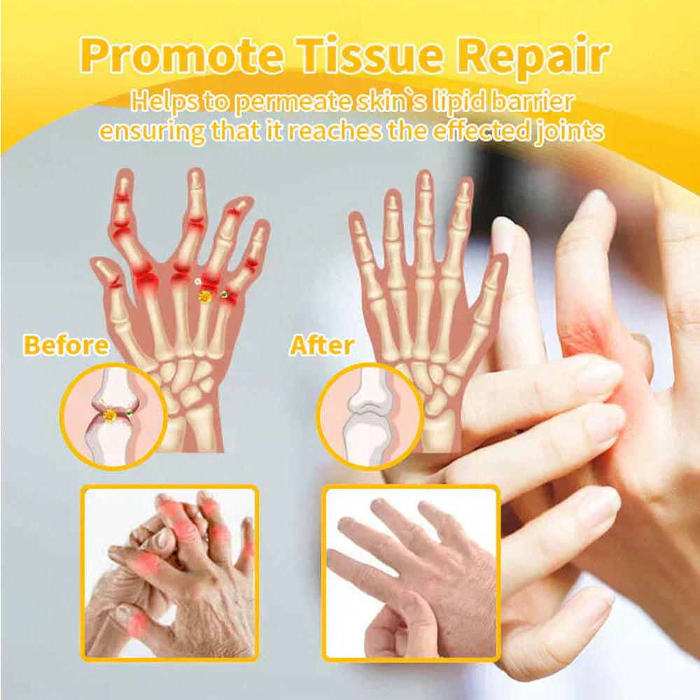 đ§đOurlyard⢠Magnesium Oil & Bee Venom Joint Healing Sprayđ¨ââď¸Orthopaedic Association (BOA) Approved