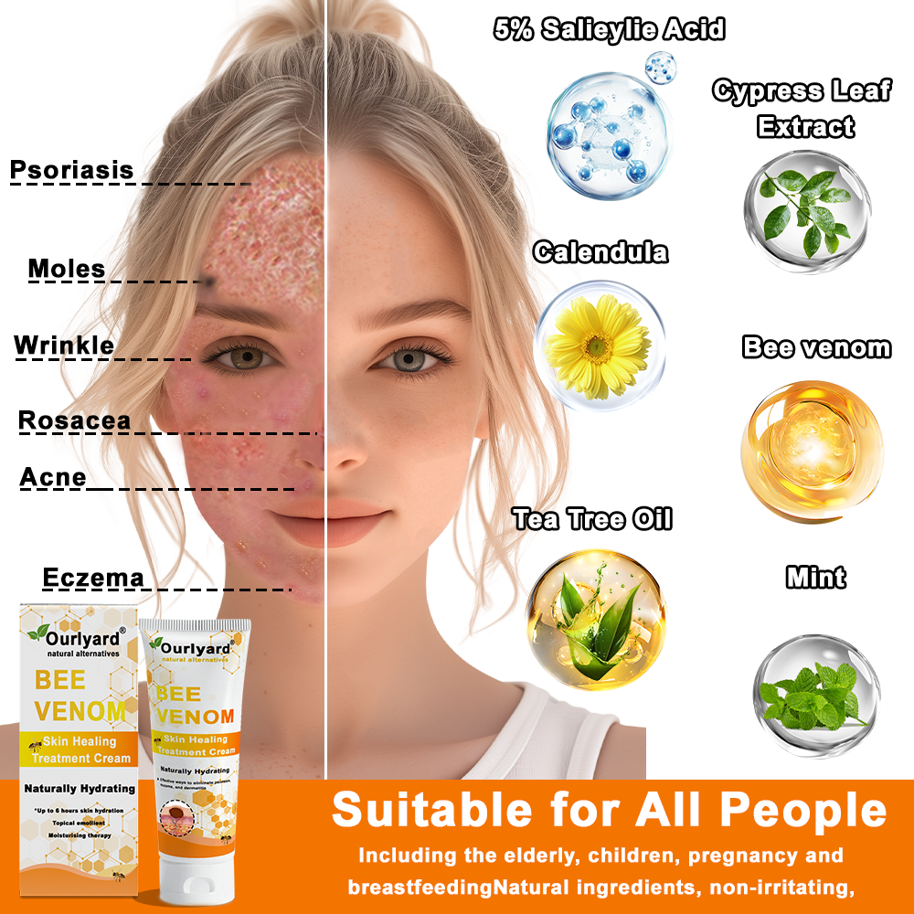 OurlyardÂŽ Official Store: Bee Venom Skin Treatment Creamđ¨ââď¸British Association of Dermatologists (BAD) Approved