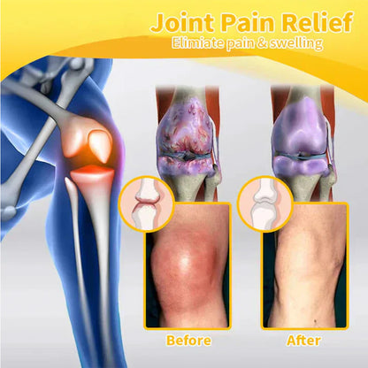 💧🐝Ourlyard™ Magnesium Oil & Bee Venom Joint Healing Spray👨‍⚕️Orthopaedic Association (BOA) Approved