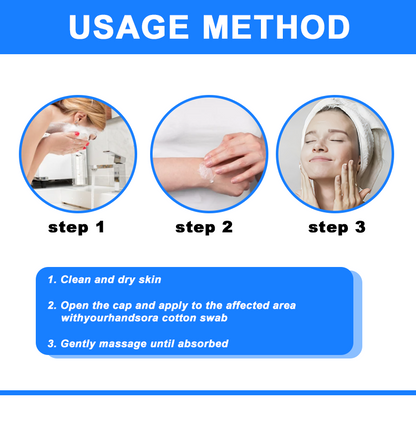 ✅NHS Approved: Ourlyard® Eczema Cream Skin Treatment(Relieves eczema, dermatitis, psoriasis, skin allergies, skin irritation, pigmentation, dry skin, and other common skin issues.)