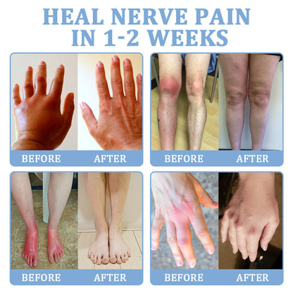 ✅Official Store: flysmus™ Magnesium Pain Relief Repair Cream 👨‍⚕️ Approved by the Medical Products Regulatory Agency (MHRA) (Relief of neuropathy, muscle spasms, cramps or twitches, poor bone health and other problems)