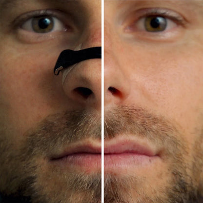 ✅Official Store:Ourlyard™ Magnetic Nasal Band